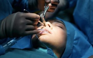 Home 8 of the most common functional rhinoplasty - Breathing with nose surgery