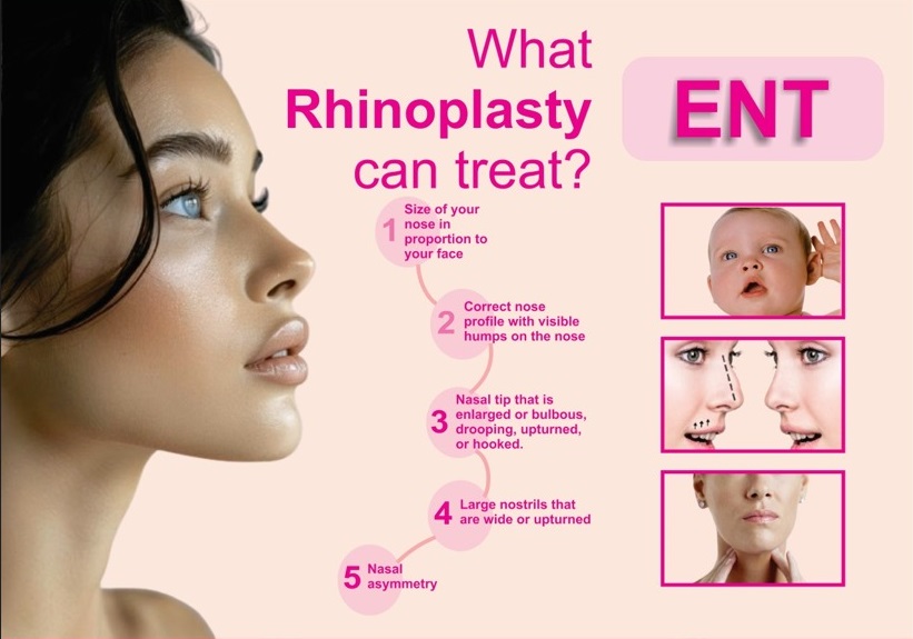 What is Rhinoplasty