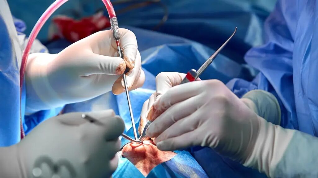 rhinoplasty surgery 1355269850